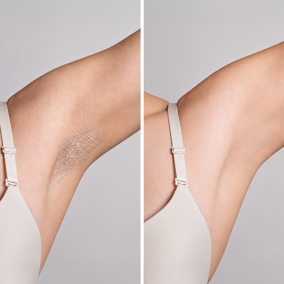 LoweSkin image